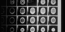 Brain Images